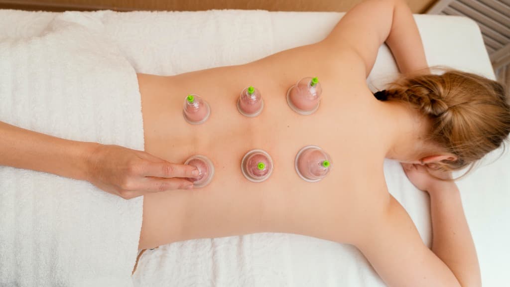 Cupping Therapy